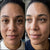 <p>Faded Dark Spots & Pigmentation</p>