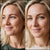 <p>Smoothed Fine Lines & Wrinkles</p>