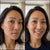 <p>Smoothed Fine Lines & Wrinkles</p>